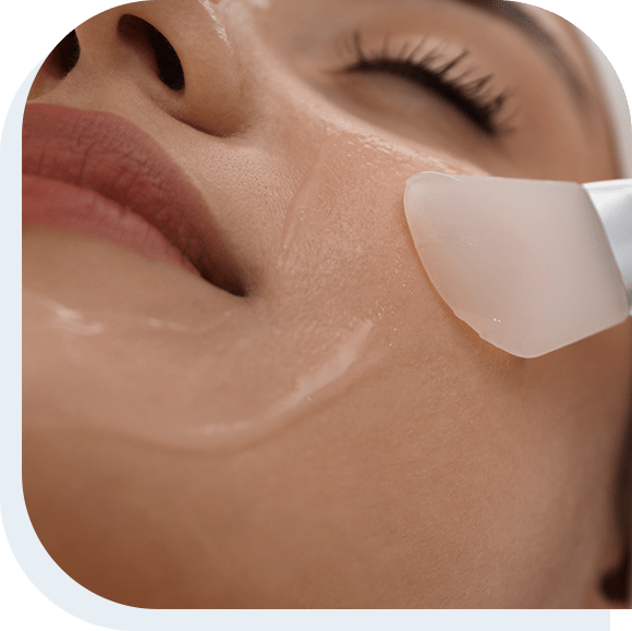 Closeup of a Young woman receiving chemical peel treatment