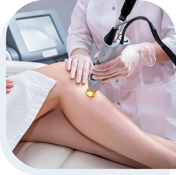 A patient having laser hair removal procedure on their legs