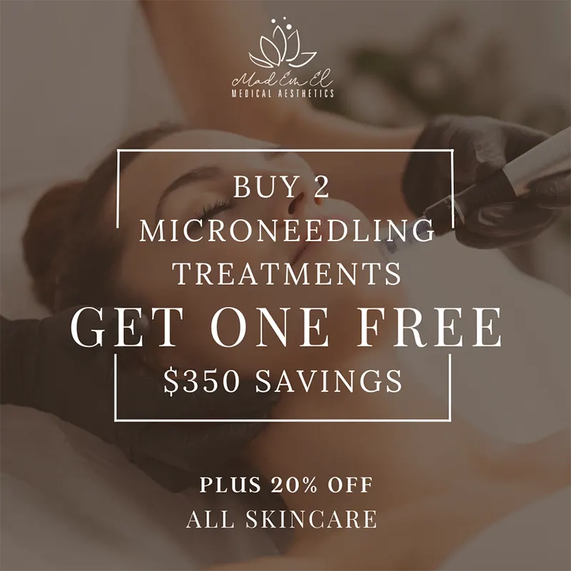 Buy 2 Microneedling Treatments Get One Free