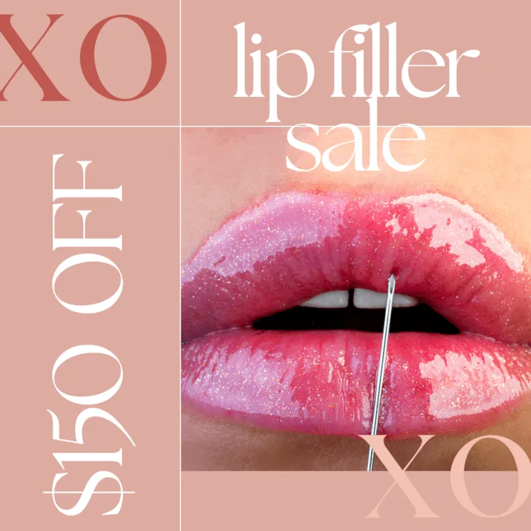 Lip Filler Sale - $150 Off