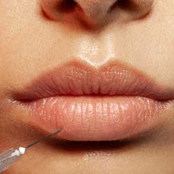 Lips Injections