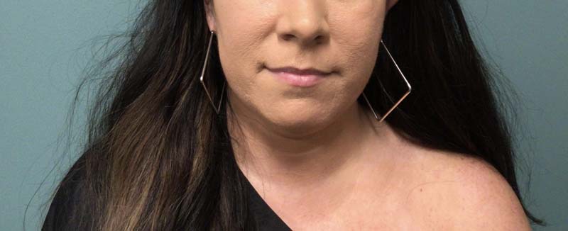 Before Lips Kysse Vollure