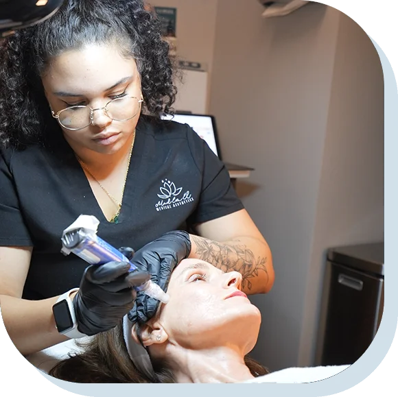 Microneedling-Service