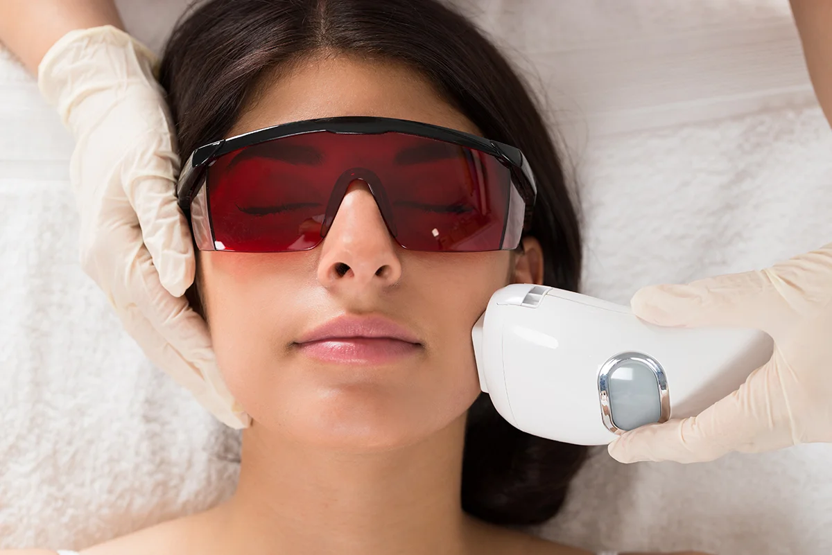 A patient undergoing a facial laser skin treatment with protective eye gear.