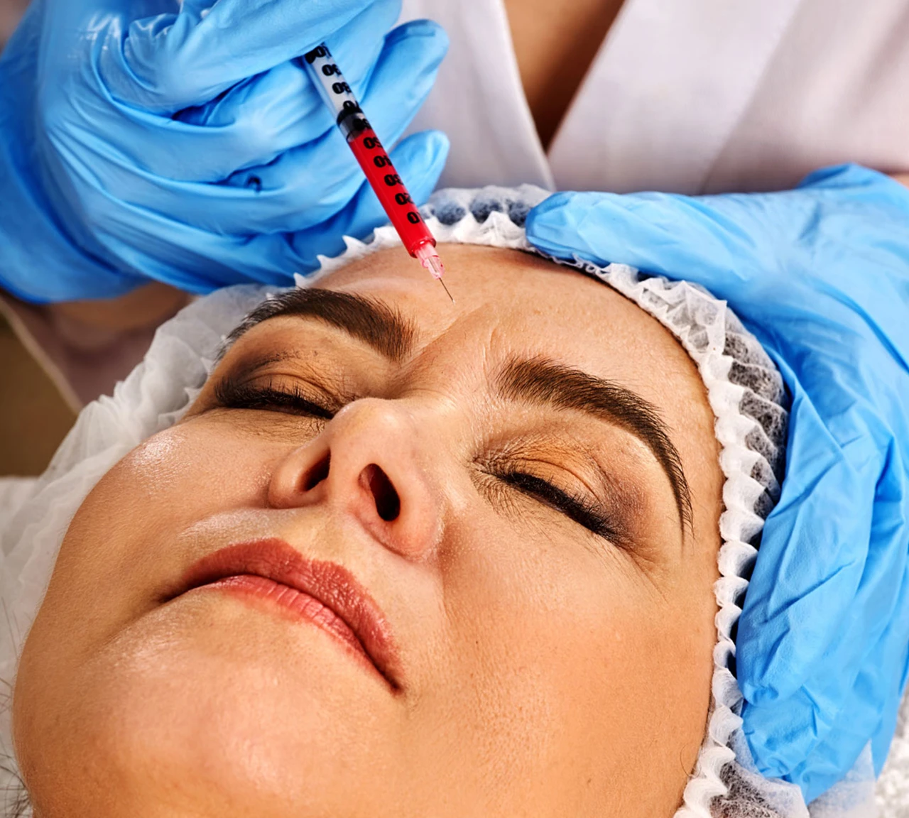 An aesthetic healthcare provider in blue medical gloves administering a facial injection to a patient's upper forehead.